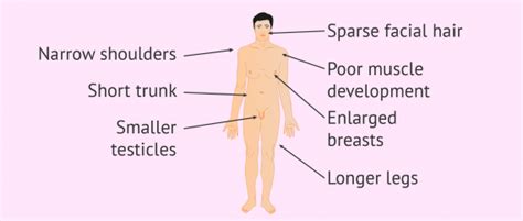 Klinefelter Syndrome Xxy Syndrome Symptoms Causes