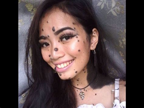girl bullied as monster over excessive moles may become miss universe malaysia 2018 [photos