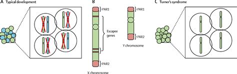 Cognitive And Neurological Aspects Of Sex Chromosome Aneuploidies The