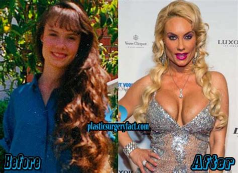 coco austin plastic surgery before and after pictures