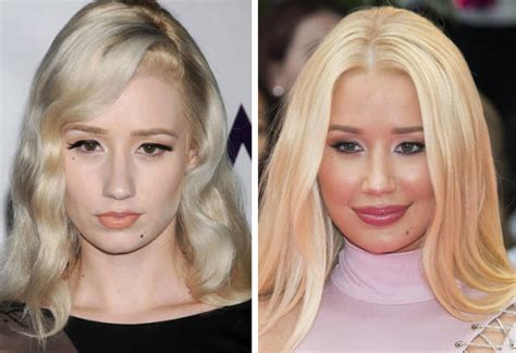 celebrities before plastic surgery 10 pics
