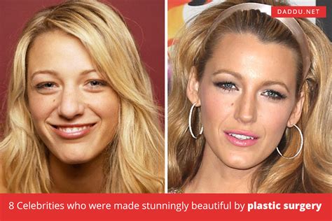 8 Celebrities Who Were Made Stunningly Beautiful By