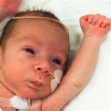 preemies growth developmental milestones healthychildrenorg