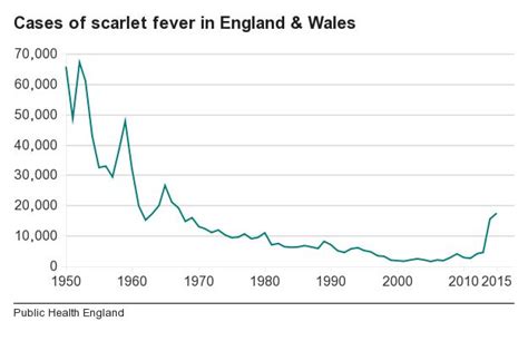 Rise In Scarlet Fever Cases Shows 49 Year High Health Experts Say