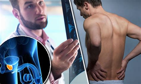 Men Still Unaware Of Major Prostate Cancer Symptoms Uk