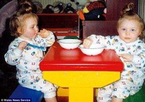 identical twins with illness so rare it was named after them can finally speak again using