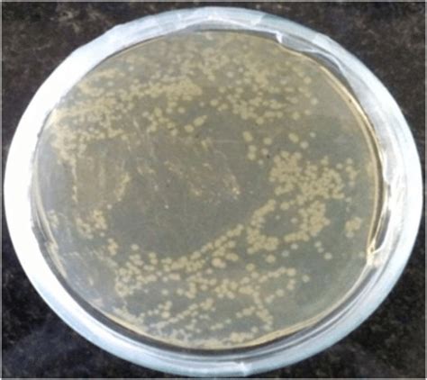 Agar Plate Showing Growth Of Escherichia Coli Bacterial