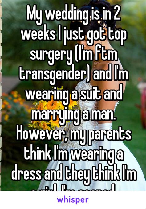 top surgery confessions 17 transgender men share their thoughts