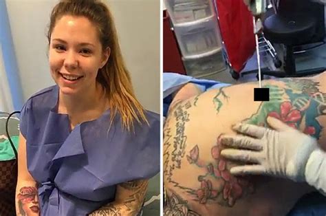 teen mom s kailyn gets brazilian butt lift and it s broadcast live on snapchat daily star