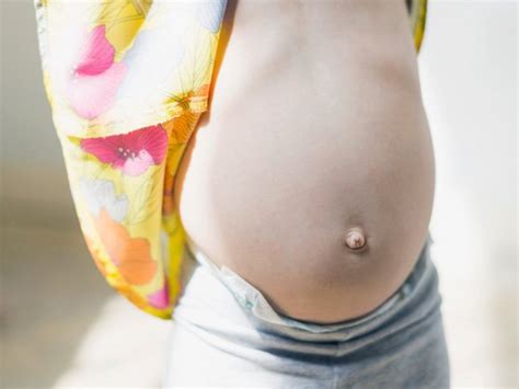 What Causes An Outie Belly Button