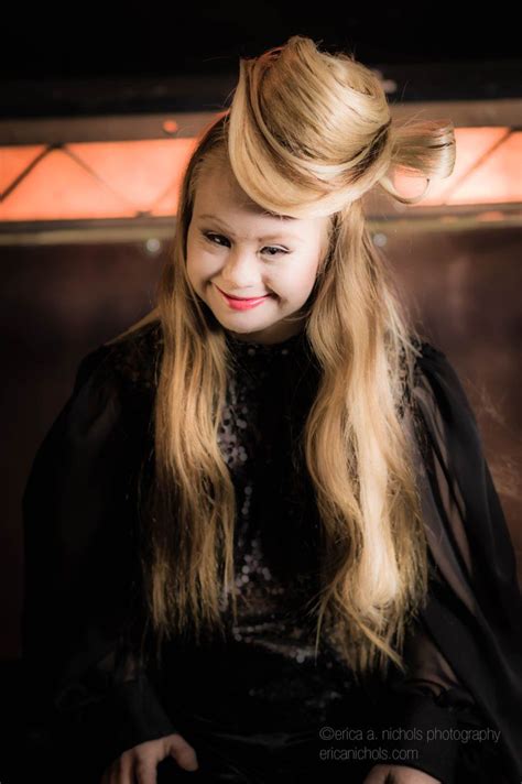 this model with down syndrome posed for the most romantic