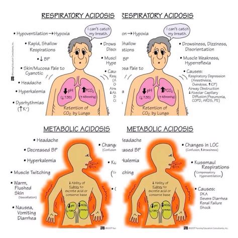 acidoses vs alkalosis phartoonz