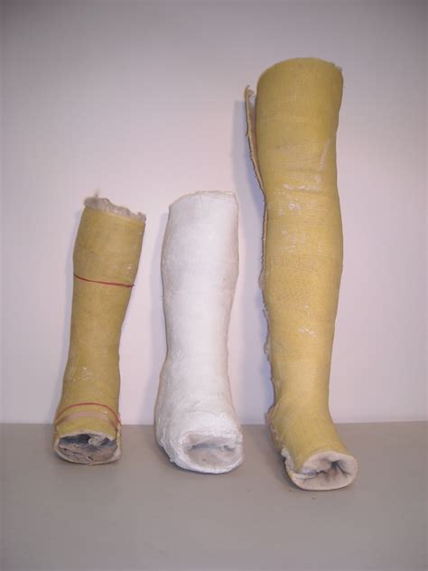 plaster cast leg