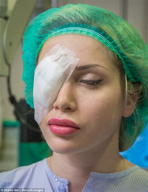 surgery obsessed model pixee fox gets implants to make her eyes