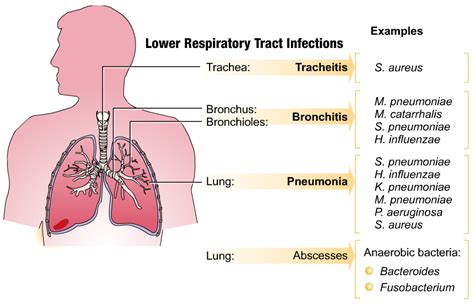 respiratory tract infections  infections