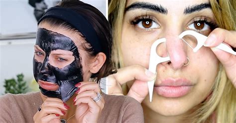 how to get rid of an outbreak of blackheads according to experts