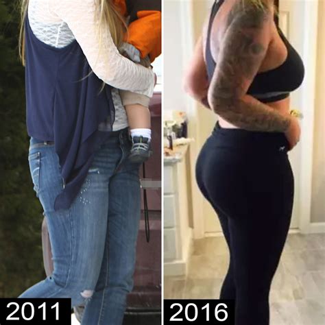 kailyn lowry s plastic surgery transformation before and after pics