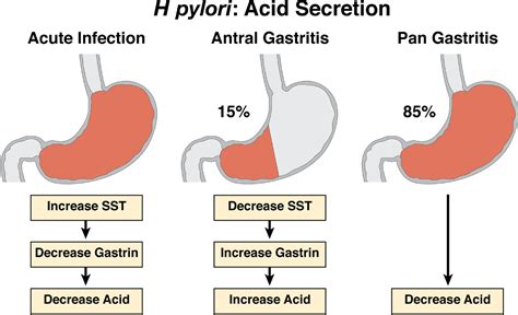 control  gastric acid secretion  health  disease gastroenterology