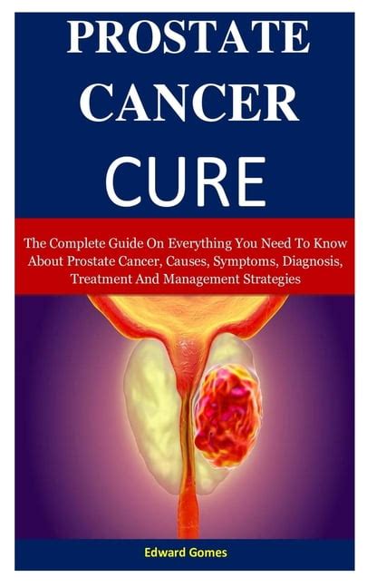 prostate cancer diagnosis and treatment pdf overview and