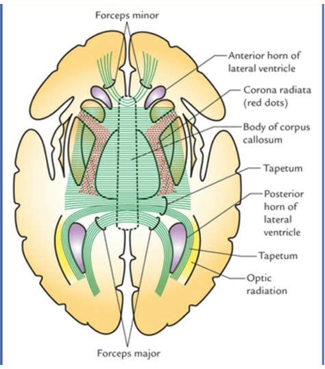 corpus callosum imedscholar