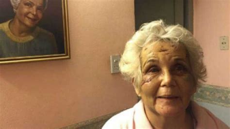 Una Abuela Fue Atacada Brutalmente Por Su Exmarido Diario Panorama
