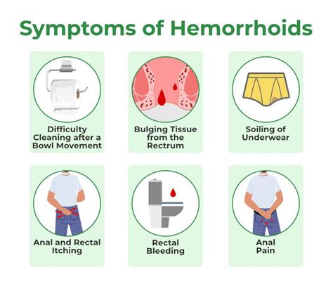 hemorrhoids or piles types symptoms cause and treatment