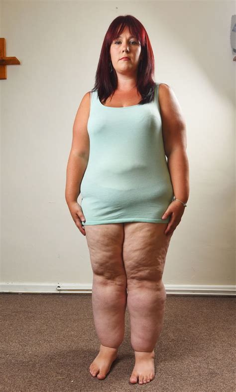 Fat Leg Woman Fat Sexy Leg
