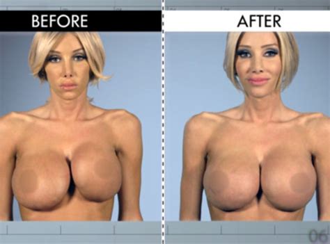 pornstars with fake tits before and after breast