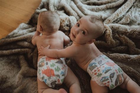 mono mono twins  rare  high risk pregnancy hamilton health sciences