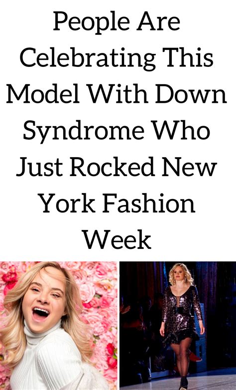 people are celebrating this model with down syndrome who
