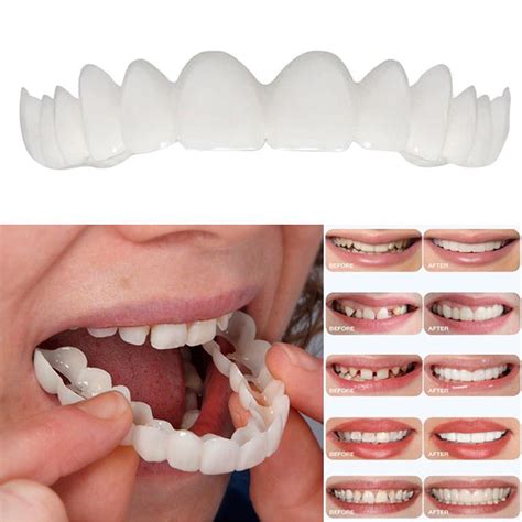 silicone smile teeth cosmetic veneers dentistry dental snap  comfort covers ebay