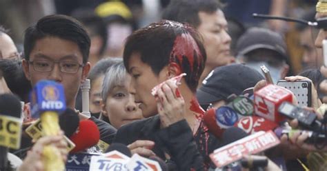 attack on denise ho in taipei sparks new appreciation of the lesbian
