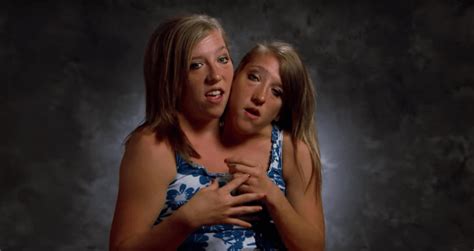 Abby And Brittany Hensel Are The World S Most Famous Conjoined Twins