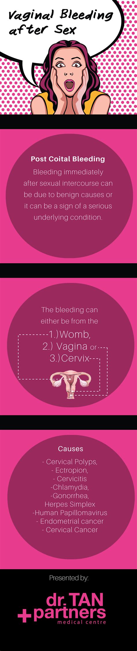 The Causes Of Vaginal Bleeding After Sex Post Coital Bleeding Hiv