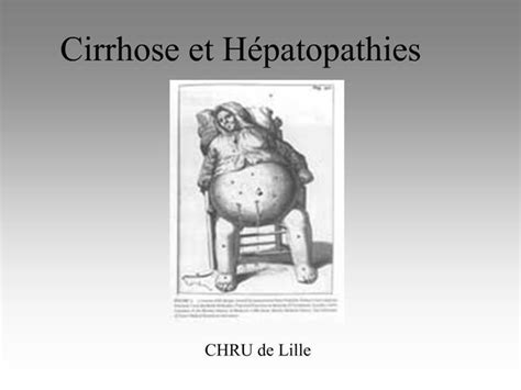 Ppt Cirrhose Et H Patopathies Powerpoint Presentation Free Download