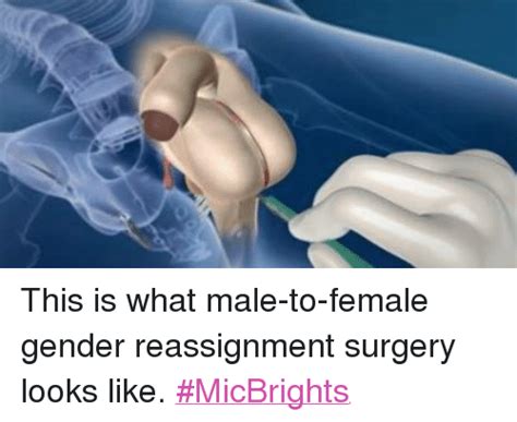 this is what male to female gender reassignment surgery looks like
