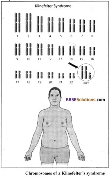 rbse solutions for class 12 biology chapter 36 man chromosomal