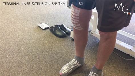 improving knee extension post tka  gait youtube
