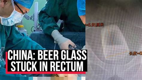 Man In China Undergoes Surgery To Have Beer Glass Removed From His