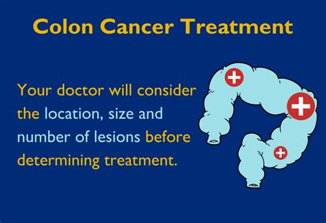 Colon Cancer Treatment What To Know About Surgery Johns Hopkins Medicine
