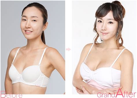 Breast Augmentation Asian Sex Scenes In Movies