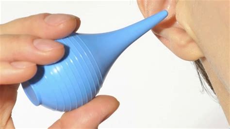 popular remedy  remove ear wax  hydrogen peroxide
