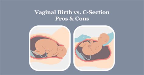 Vaginal Birth Versus C Section Pros And Cons Mamaway Maternity