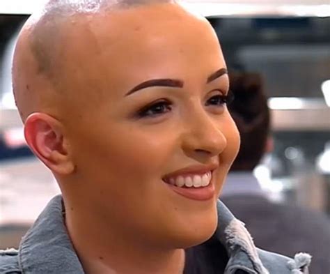 first dates alopecia sufferer praised for her bravery daily mail online
