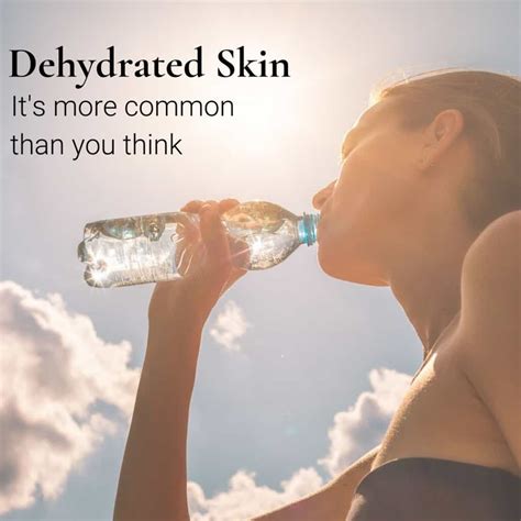 dehydrated skin   common