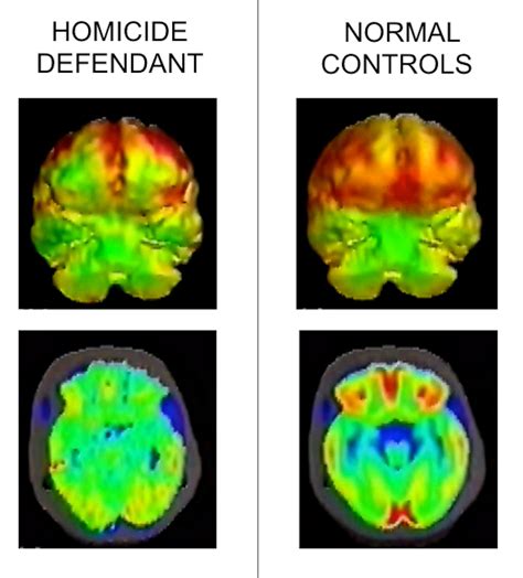 brain scans explain crime  washington post