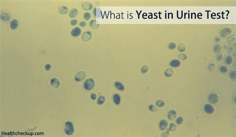yeast  urine test   yeast cells  urine