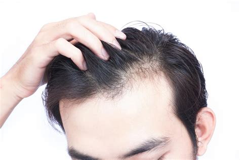 hair loss treatment hair fall cure cost  mumbai india qr