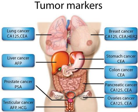 Tumor Marker Testsconners Clinic Alternative Cancer Coaching
