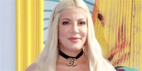 Tori Spelling Sets Plastic Surgery Rumors Straight In New Interview